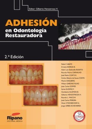 Adhesión en Odontología Restauradora
