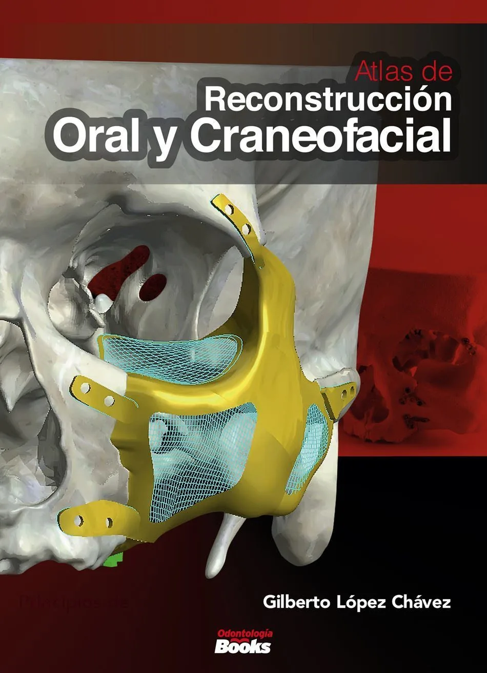 Atlas de Reconstrucción Oral y Craneofacial. Principios de Bioingeniería