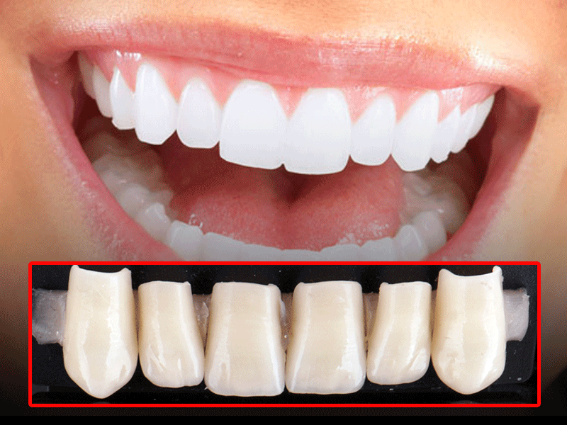 CARILLAS dentales