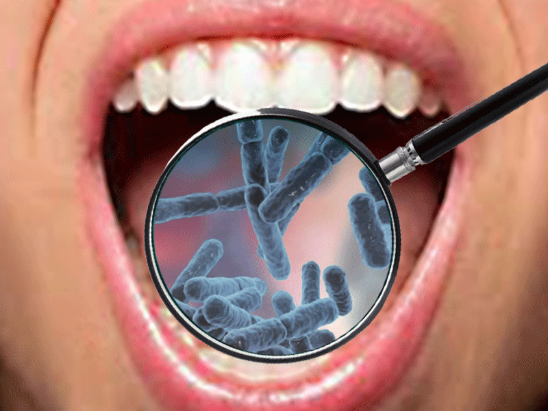probióticos en la salud oral