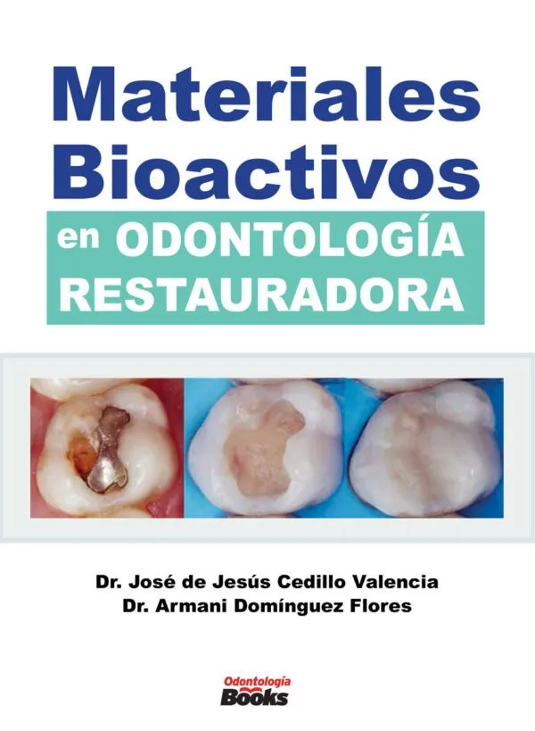 Materiales Bioactivos en Odontología Restauradora